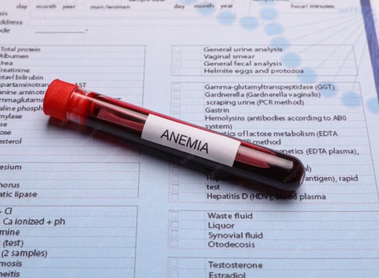 Anemia pode se desenvolver de forma silenciosa e exige atenção aos primeiros sinais